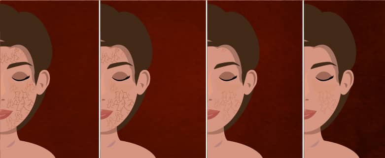 Ayurvedic skincare routine for Vata skin: